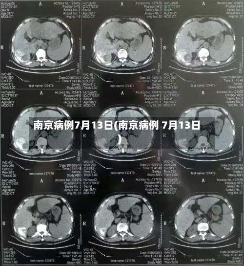 南京病例7月13日(南京病例 7月13日)-第3张图片